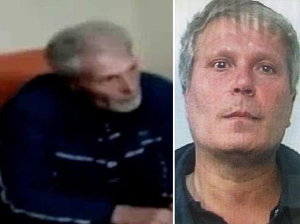 Pelle prima e dopo